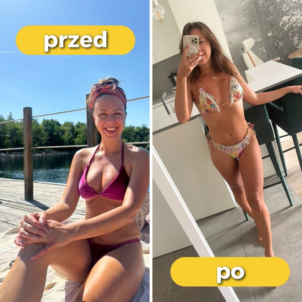 SIBO: Jak Odnalazłam Klucz do Zdrowia i Odzyskałam Komfort Życia